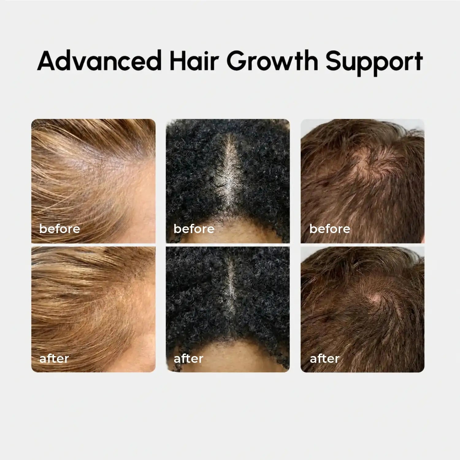4-in-1 Hair Growth Spray