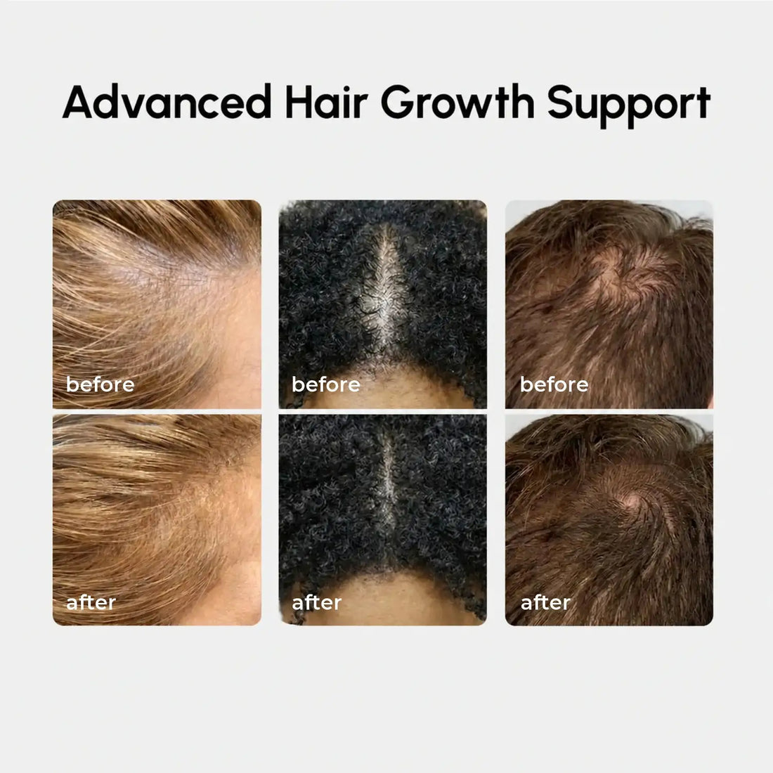 4-in-1 Hair Growth Spray
